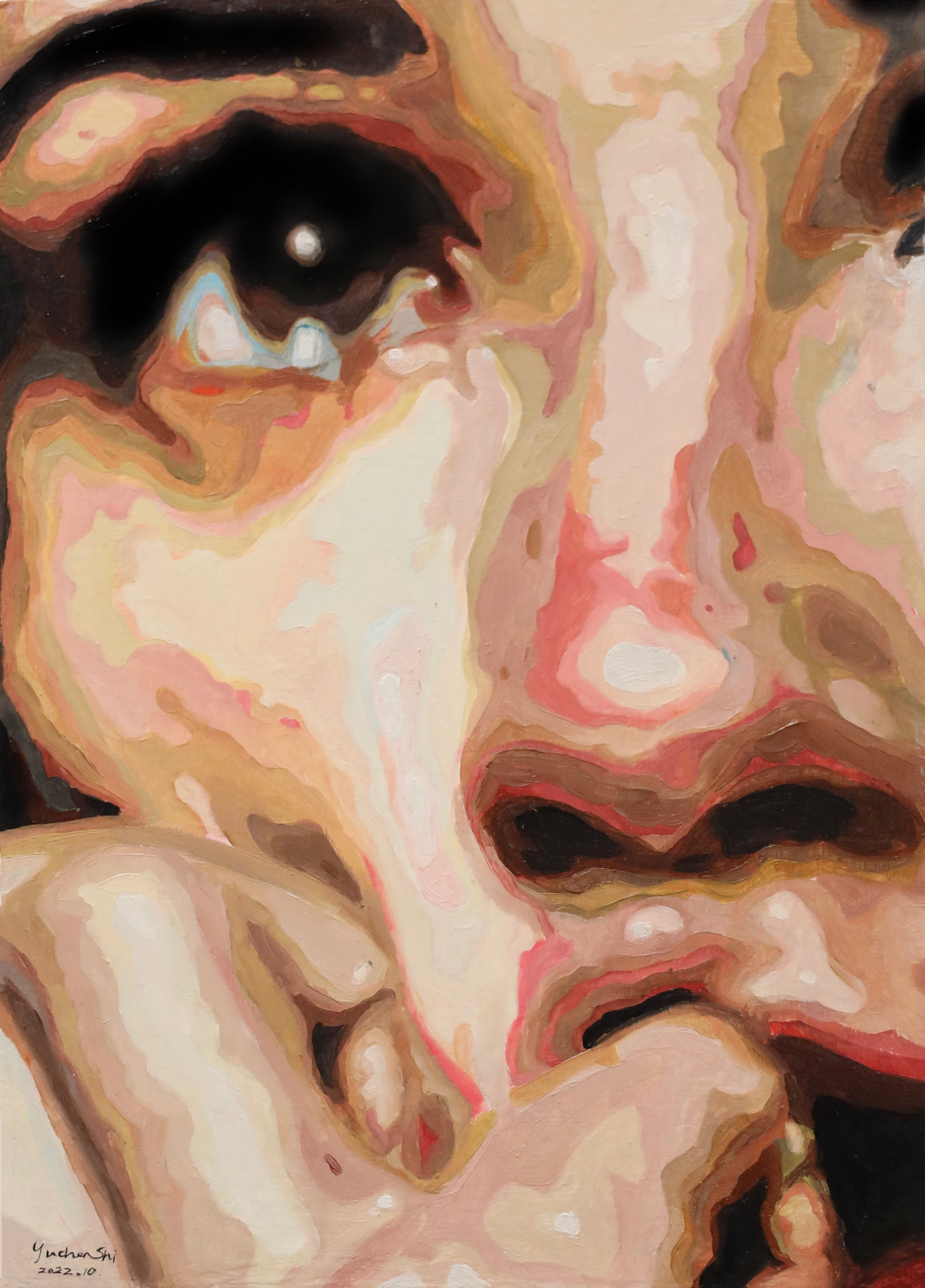 vertigo